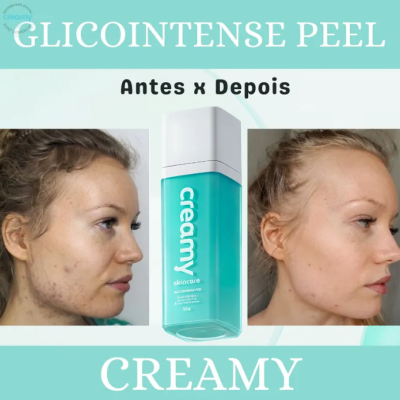 Creamy&#x20;Glicointense&#x20;Peel&#x20;-&#x20;Antiacne&#x20;E&#x20;Manchas&#x20;30g