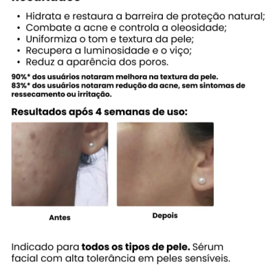 Creamy&#x20;&#x00C1;cido&#x20;L&#x00E1;tico&#x20;Antiacne&#x20;e&#x20;Sebo&#x20;reguladora&#x20;30g