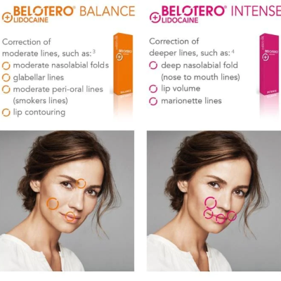 Belotero&#x20;Soft&#x20;Lidocaine&#x20;1ml