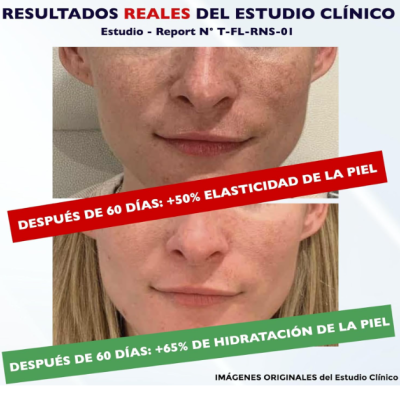 Florence&#x20;-&#x20;Bio&#x20;S&#x00E9;rum&#x20;Facial&#x20;com&#x20;Vitamina&#x20;C,&#x20;E&#x20;e&#x20;&#x00C1;cido&#x20;Hialur&#x00F4;nico&#x20;&#x2705;PRONTA&#x20;ENTREGA