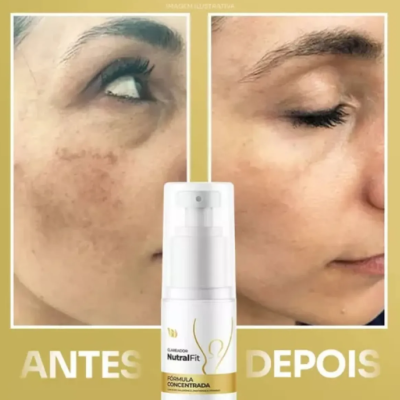 Clareador&#x20;Nutral&#x20;Fit&#x20;Corpo&#x20;E&#x20;Rosto&#x20;Concentrado&#x20;50ml&#x2705;PRONTA&#x20;ENTREGA