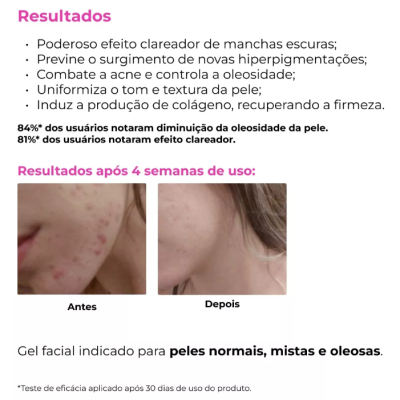 Creamy&#x20;&#x00C1;cido&#x20;Mand&#x00E9;lico&#x20;30g&#x20;Gel&#x20;Clareador&#x20;Antiacne&#x2705;PRONTA&#x20;ENTREGA
