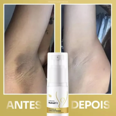 Clareador&#x20;Nutral&#x20;Fit&#x20;Corpo&#x20;E&#x20;Rosto&#x20;Concentrado&#x20;50ml&#x2705;PRONTA&#x20;ENTREGA