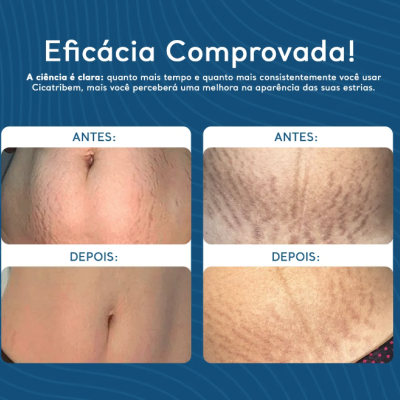 Regenerador Dérmico 150g - Cicatribem