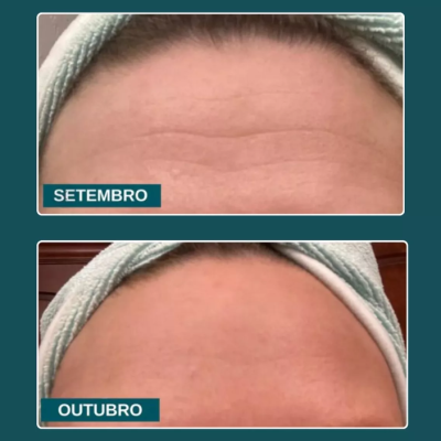 Lucence&#x20;-&#x20;Vitamina&#x20;Beauty&#x20;Blend&#x20;Hidrata&#x00E7;&#x00E3;o&#x20;Firmeza&#x20;De&#x20;Dentro&#x20;Para&#x20;Fora