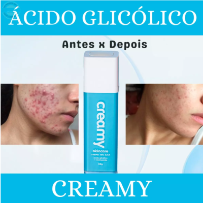 Ácido Glicólico Creamy Anti-idade Renovador Facial✅PRONTA ENTREGA Ácido Glicólico Creamy Anti-idade Renovador Facial✅PRONTA ENTREGA