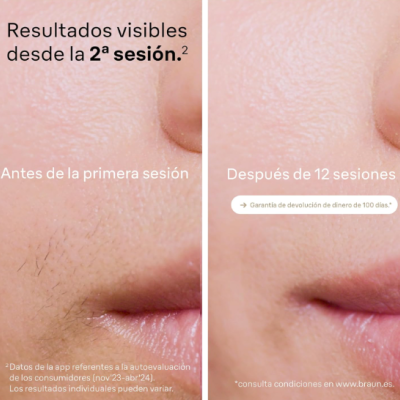 Braun&#x20;Silk-expert&#x20;Pro&#x20;5&#x20;&#x2013;&#x20;Depila&#x00E7;&#x00E3;o&#x20;a&#x20;Laser&#x20;Tecnologia&#x20;IPL&#x20;&#x2B;&#x20;V&#x00E9;nus&#x20;-&#x20;&#x2705;PRONTA&#x20;ENTREGA