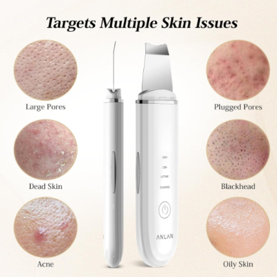 Esfoliante Ultrassónico Facial – Limpeza Profunda ✅PRONTA ENTREGA