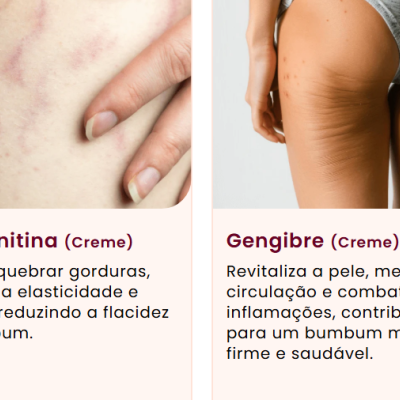 POPOZUDA&#x20;Kit&#x20;Creme&#x20;&#x2B;&#x20;Spray&#x20;-&#x20;&#x2705;PRONTA&#x20;ENTREGA